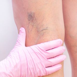 Alleviamento Rapido del Dolore